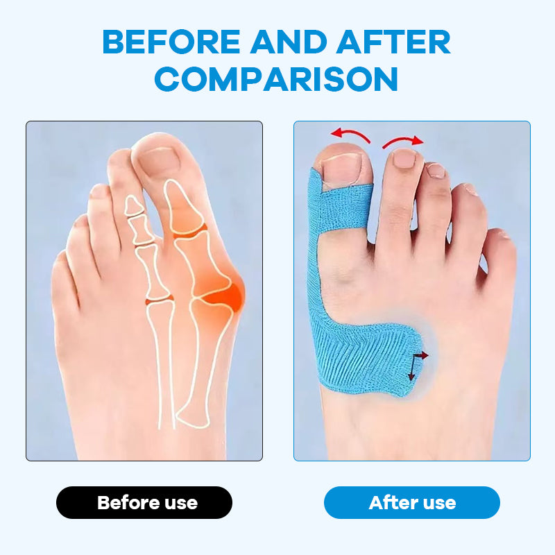Pre-cut kinesiology tape for hallux valgus