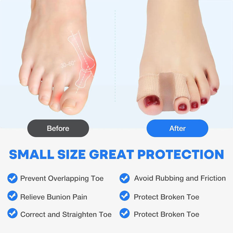 🦶✨ Toe separators & bunion corrector – Pain-free relief for bunions and overlapping toes for women & men! ✨